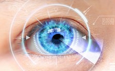 Trí tuệ nhân tạo của IBM giúp chữa bệnh tăng nhãn áp