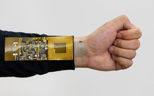 Cảm biến gắn trên cơ thể không cần dây cấp nguồn