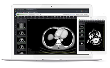 Ra mắt ứng dụng hỗ trợ chẩn đoán hình ảnh từ xa IPACS Telerad