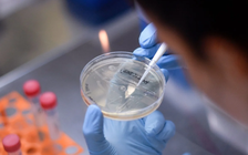 Tin tặc tấn công các trung tâm nghiên cứu Covid-19 của Mỹ