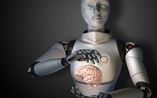 Trí tuệ nhân tạo hỗ trợ xác định xương gãy trong chụp X-quang