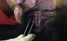 Cô gái bị nhóm bạn chém nhập viện vì mâu thuẫn tiền bạc