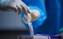 TP.HCM: Trưa 5.7, có 196 ca nhiễm Covid-19 mới, bệnh nhân thứ 13 tử vong