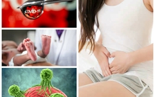 Bắt đầu ngày mới với tin tức sức khỏe: Đầy hơi dai dẳng, khám ung thư ngay!