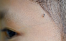 TP.HCM: Ca tử vong thứ 7 do sốt xuất huyết