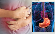 Ngày mới với tin tức sức khỏe: Bạn nên cẩn trọng khi đau ở chỗ này