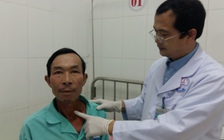 Cứu bệnh nhân bị hóc xương cá cả chục ngày