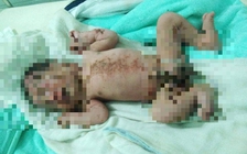 Xót xa trẻ bị bỏ rơi còn nguyên dây rốn