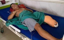 Cựu đội trưởng Đắk Lắk Cao Hoàng Hải bị cưa chân trước thôi nôi con 1 tuần