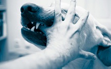 Bé trai tử vong vì bệnh dại sau khi bị chó nhà hàng xóm cắn