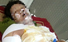 Sau chầu nhậu, chồng tưới xăng đốt vợ