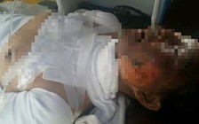 Bị người tình tưới xăng châm lửa đốt, một phụ nữ tử vong