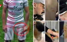 Sốc với vụ cầu thủ Thổ Nhĩ Kỳ lận dao cạo vào sân 'cứa' đối thủ