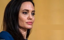 Angelina Jolie bị chứng liệt cơ mặt sau một năm ly hôn