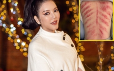 Fan lo lắng cho tình trạng sức khỏe của Lý Nhã Kỳ