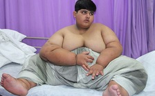 Cậu bé nặng nhất thế giới phải phẫu thuật để sống sót