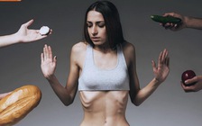 Cảnh báo giới trẻ theo trào lưu ăn kiêng để ốm trơ xương