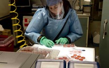 Kinh hãi những vụ vi rút chết chóc rò rỉ khỏi phòng thí nghiệm