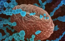 Đa số người mắc Covid-19 kéo dài bắt đầu bằng triệu chứng nhẹ