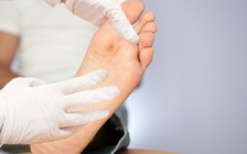 7 dấu hiệu cảnh báo biến chứng nghiêm trọng của bệnh tiểu đường