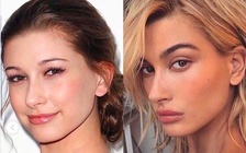 Vợ Justin Bieber vướng nghi án phẫu thuật thẩm mỹ