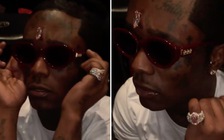 Rapper Mỹ cấy kim cương hồng 24 triệu USD lên trán