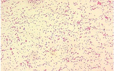 Hàng ngàn người ở Trung Quốc mắc bệnh do nhà máy vắc xin bất cẩn