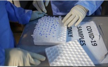 Một bệnh nhân HIV mắc Covid-19 hơn 210 ngày với hơn 30 đột biến