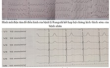 Cứu sống bệnh nhân 'tim đập 300 lần/phút'