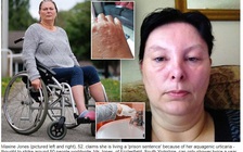 Dị ứng với... nước, người phụ nữ chỉ có thể tắm hai lần trong một năm