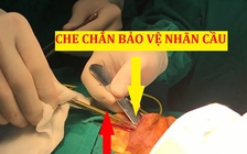 Mổ xuyên đêm cứu bé trai bị thanh sắt đâm xuyên hốc mắt vào trong não