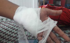 Chém đứt 3 ngón tay của 'con nợ'