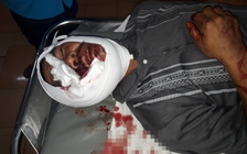 Ẩu đả trong lúc hỏi thuê chòi để kinh doanh, một người tử vong