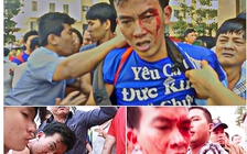 Giám đốc công ty bảo vệ ở Era Town nói người dân 'tự té ngã, đổ máu'