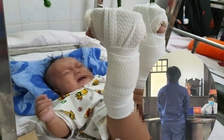 Người cha đánh con trai 4 tháng đến gãy chân: Đổ lỗi vì say và... giận vợ