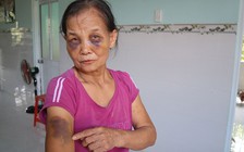 Nóng trên mạng xã hội: Phẫn nộ con dâu đánh mẹ chồng bầm tím mặt