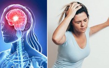 'Giờ vàng' để cứu người bị đột quỵ là bao lâu?