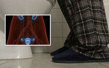 Thấy nước tiểu có màu này, đi khám ung thư bàng quang ngay!