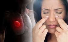 5 triệu chứng ung thư phổi có thể bạn không nhận ra