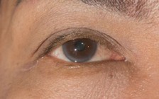 6 dấu hiệu kỳ lạ có thể bạn mắc bệnh tim