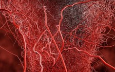 Khoa học phát hiện lý do đau ngực dữ dội, đi khám không phát hiện ra bệnh