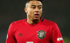 Siêu mẫu Playboy đăng ảnh nóng và nhờ Jesse Lingard chấm điểm