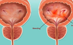 TP.HCM: Một phòng khám tư nhân áp đặt kết quả siêu âm cho bệnh nhân