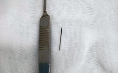Quảng Nam: Kim khâu dài 3 cm trong ống cổ tay bệnh nhân
