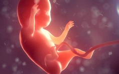 Phát hiện bào thai chị em song sinh còn sống trong hộp sọ bé 1 tuổi