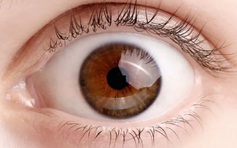 Người bị cao huyết áp cần phòng tránh những bệnh mắt nào?