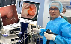 Nội soi cắt polyp đại tràng để dự phòng biến chứng ung thư tại PKĐK Thái Hòa