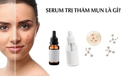 Top 10 serum trị thâm mụn cho làn da tươi sáng rạng ngời được tìm mua nhiều