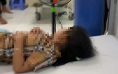 Bé gái 4 tuổi ở Bình Thuận bị chó cắn rồi phát bệnh dại, tử vong