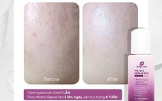 Review serum chống lão hóa Page One Matrix Repair Pro + Exosome Serum có hiệu quả không?